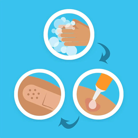 Illustration showing steps for wound care: hand washing, applying ointment, and using a Band-Aid from Flexible Sterile Rolled Gauze Dressings.