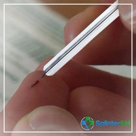 Using Painless Splinter Removal Kit by SplinterAid for easy splinter extraction