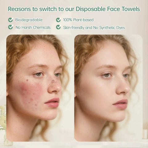 Comparison of facial skin before and after using XL Biodegradable Makeup Removal Towels For Sensitive Skin Lint Free 50 Count
