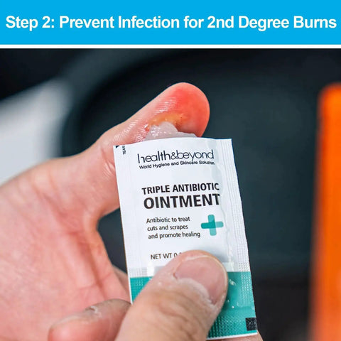 All In One Burn Care Kit From Rhino Rescue with person applying antibiotic ointment to protect burn wound.
