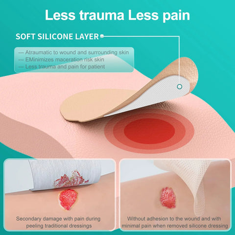 Sacral Wound Dressing Foam Bandage With Silicone Border illustration showing layer benefits and skin application