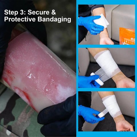 Applying bandage from All In One Burn Care Kit From Rhino Rescue With 4x4 Dressings, 3.5g Burn Gel Packets, 4 Burn Pads.