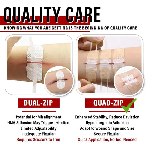 Comparison of Dual-Zip and Quad-Zip features in Zip Stitch Wound Closure Kit For Quick Sterile Suture Free Healing Of Cuts And Lacerations.