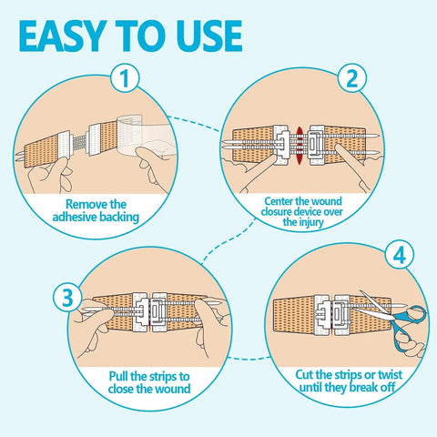 Step-by-step usage of Emergency Wound Closure Kit 2 Pack With Medical Grade Adhesive Sutures Butterfly Bandages And Clotting Technology