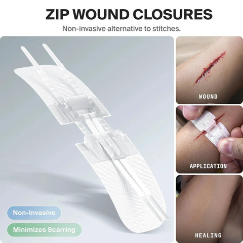 Close-up of zip wound closures from Large Pro First Aid Kit For Car Travel And Home showing application and healing process.