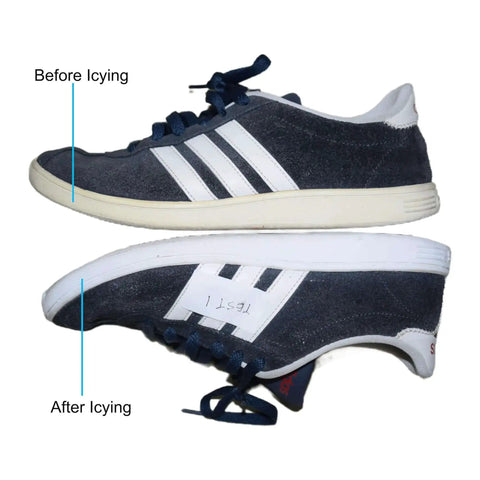 Comparison of shoes before and after using Powerful 2000W UV Light Box Curing Enclosure For Shoes And Resin, showing restored white soles.