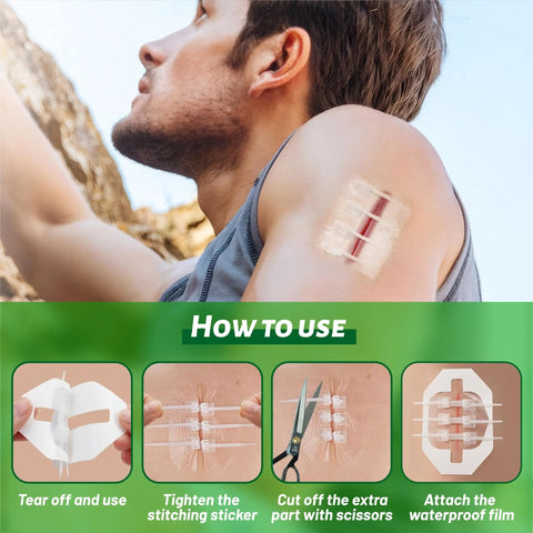 How to use Trail Ready Outdoor Trauma First Aid Kit for Camping and Hiking with Wound Closures and Adhesive Bandages.