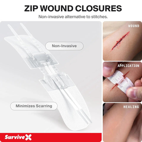 Close-up of zip stitch wound closure strips from Large First Aid Kit For Car Travel And Home With Zip Stitch Wound Closure Strips Emergency Kit For Hiking Camping And Outdoors Fully Stocked For Any Adventure Grab And Go Ready, showing non-invasive application; ideal for healing wounds
