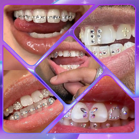 Collage of tooth gems from DIY Tooth Gem Kit With Safe Crystals, Teeth Gem Set For Fashionable Smiles, featuring multiple designs.