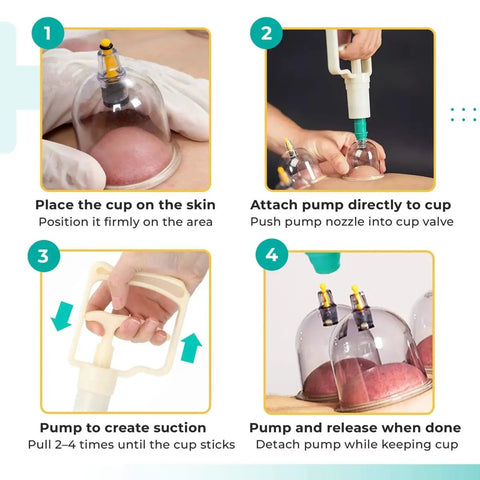 Steps for using Five Pack Manual Suction Pump For Cupping Therapy Sets, showing pump attachment and suction on skin with clear cupping jars.