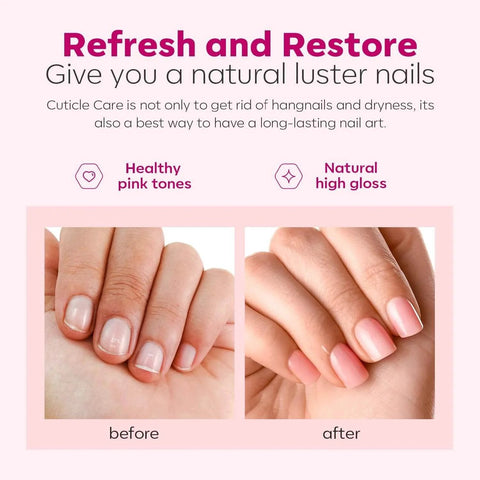 Before and after image showing nail transformation with Cuticle Remover Kit With Cream And Oil Pusher Trimmer Nipper 7 Piece DIY Manicure Set
