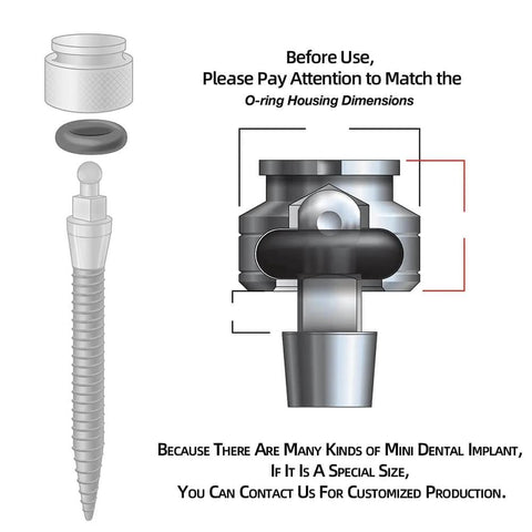 Diagram showing components of mini dental implant with Three Handy Buna-N O Ring Seal Kit With Three Easy Sizes For Mini Dental Implants Replacement, Includes 001 Size 0.029 ID X 0.04 W, 002 Size 0.042 ID X 0.050 W, 003 Size 0.056 ID X 0.060 W, 36 O Rings Total.