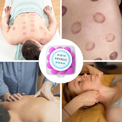 Silicone Cupping Device For Full Body Massage And Lymphatic Drainage Studio Grade Back Massager Kit in use for muscle relaxation