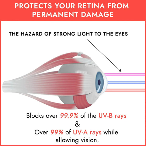 Diagram of eye protection from UV rays, emphasizing UV Eye Protection Tanning Goggles With Elastic Fit 2 Pairs In Random Colors.